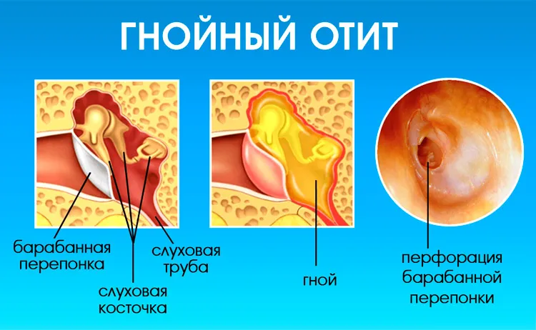 Болезни ушей у собак