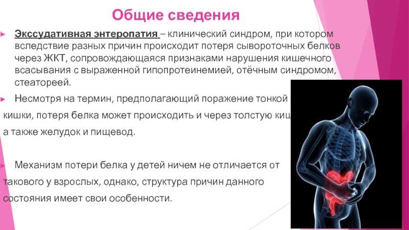 Энтеропатия с потерей белка у собак диета