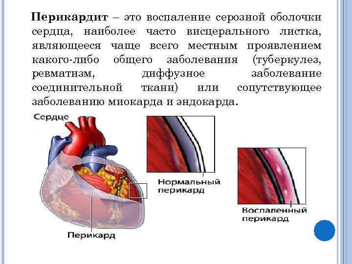 Болезни сердца у кошек: симптомы, лечение | звери дома