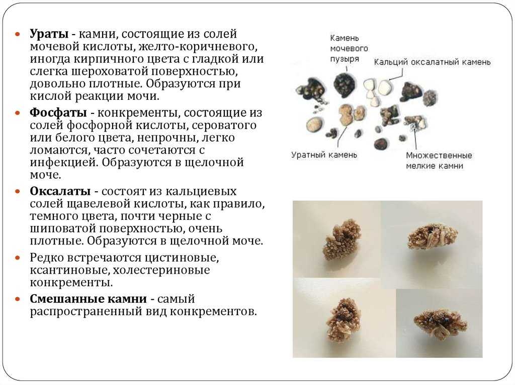 Мочекаменная болезнь у кошек (уролитиаз): симптомы и лечение