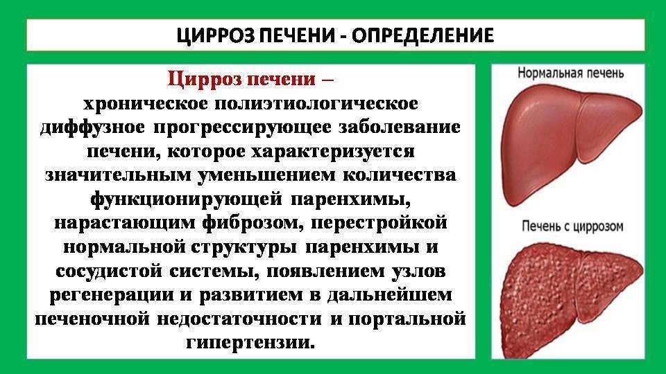 Эссенциале для кошек - инструкция по применению, дозировка