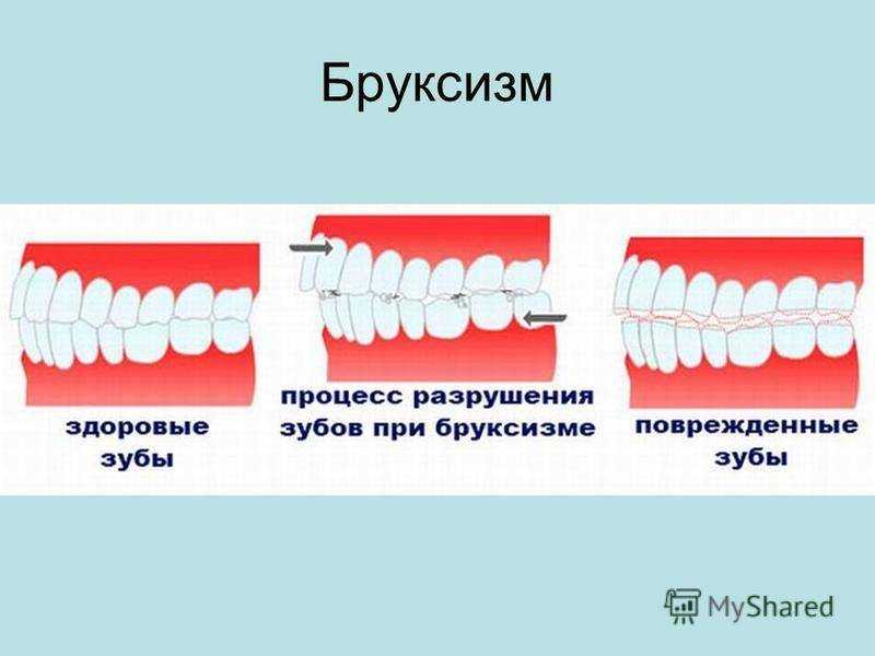 Кот щелкает челюстью: причины, лечение, диагностика