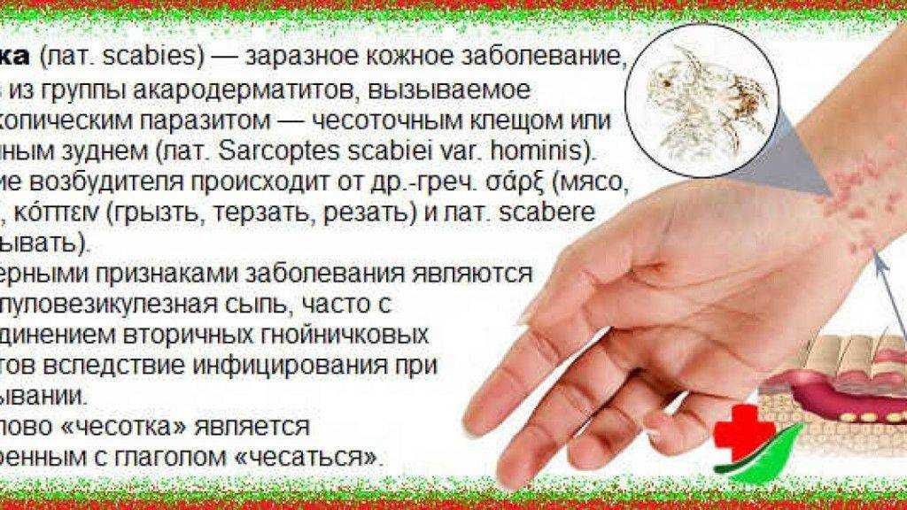 Чесотка у кошек: саркоптоз и нотоэдроз