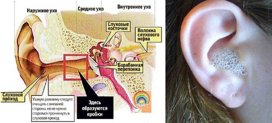 Как почистить коту уши в домашних условиях правильно, как быть, если питомец не дает это сделать?