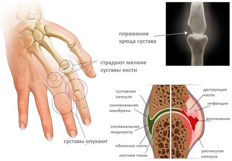 Артрит у собаки: диагностика, причины и лечение