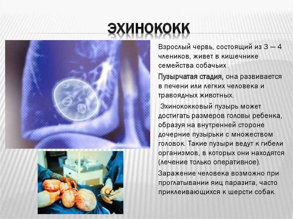 Эхинококк