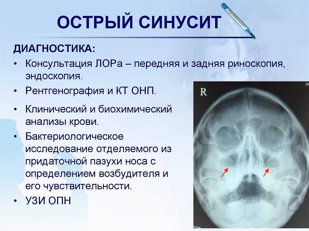 Хронический риносинусит у кошек — диагностика и лечение