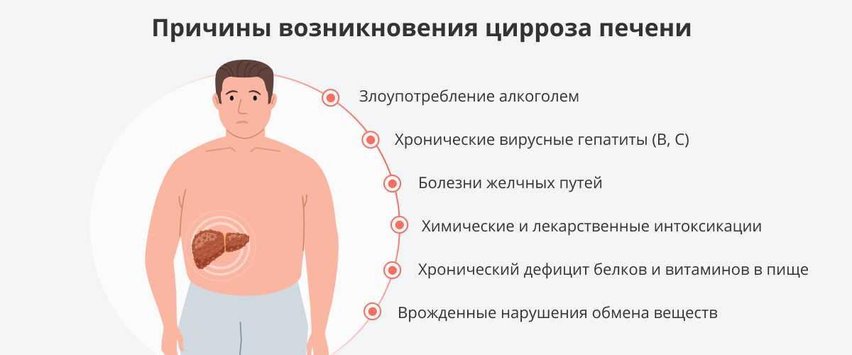 Диагноз «цирроз печени» - что нужно знать?