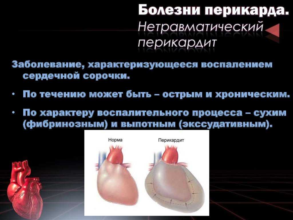 Миокардит у кошек