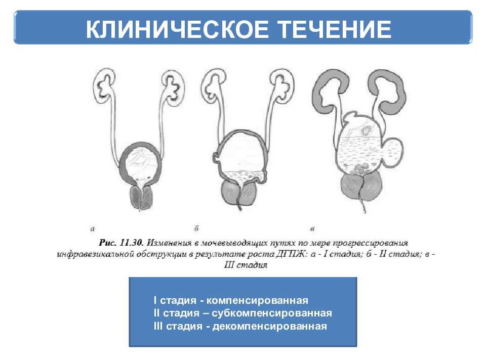 Анализ характерных симптомов, причин простатита у собак и как их лечить