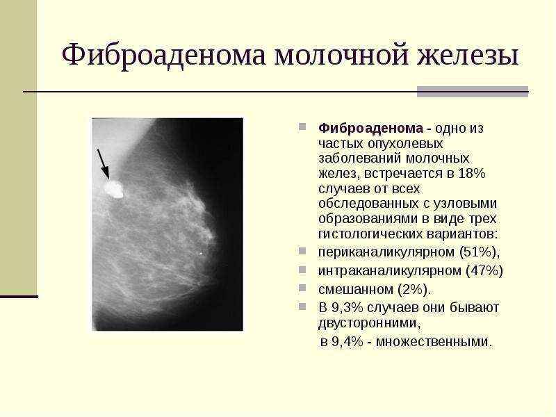 Мастопатия у кошек: симптомы