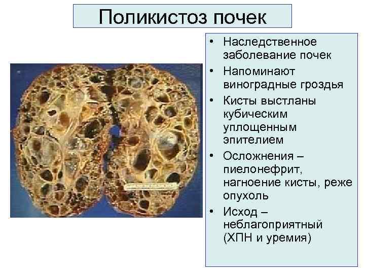 Как вылечить кисту у кошки