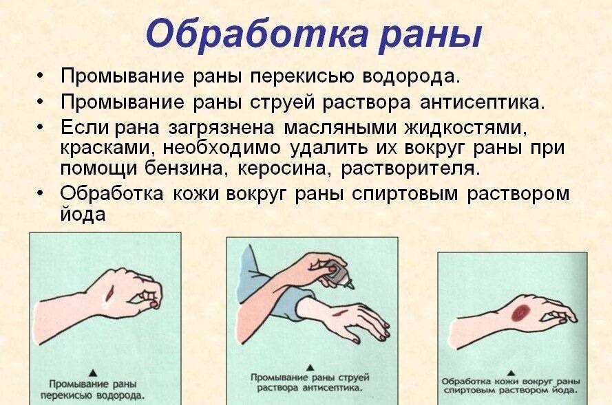 Мокнущая экзема у собак