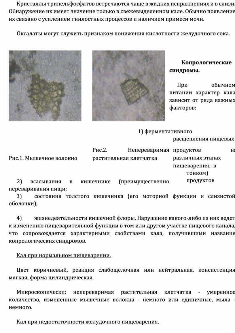 Общий анализ мочи – результаты, стандарты, расшифровка, причины отклонений