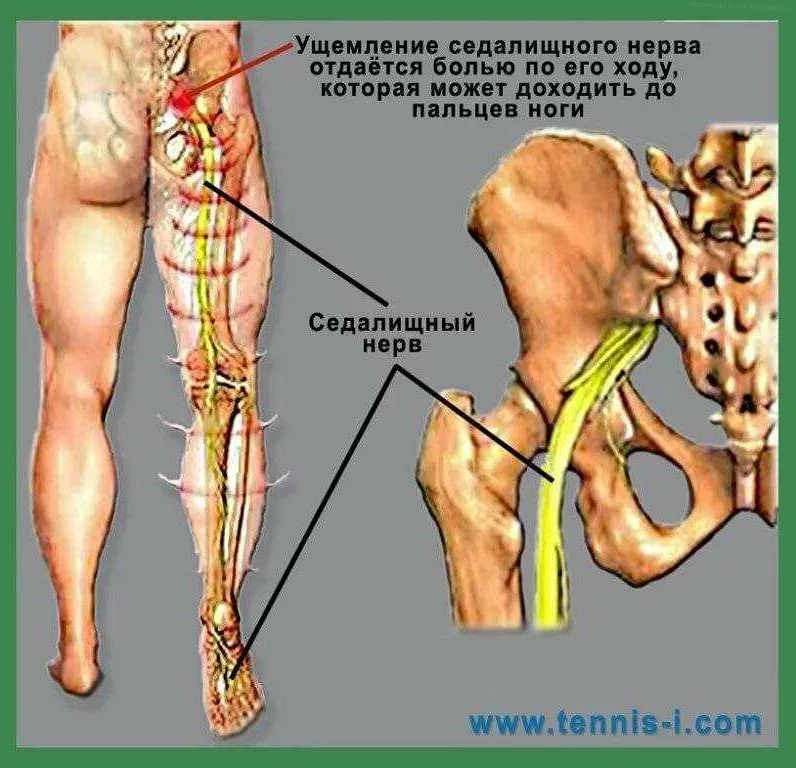 Почему возникает защемление нерва у собаки, и что нужно сделать в первую очередь