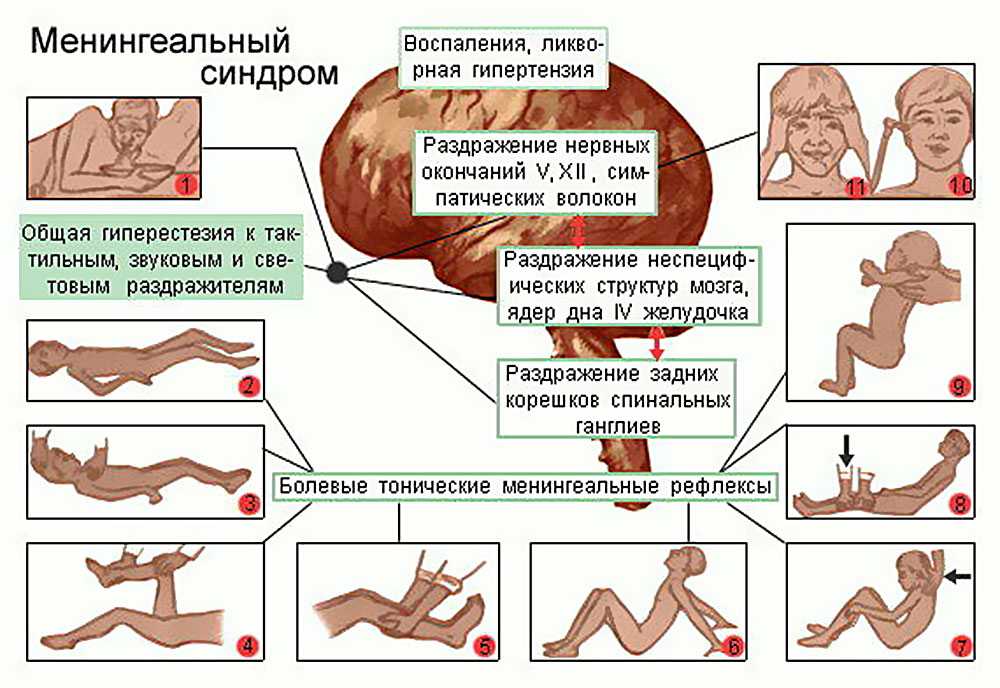 Менингоэнцефалит у собак: симптомы, прогноз и лечение некротизирующего и гранулематозного видов