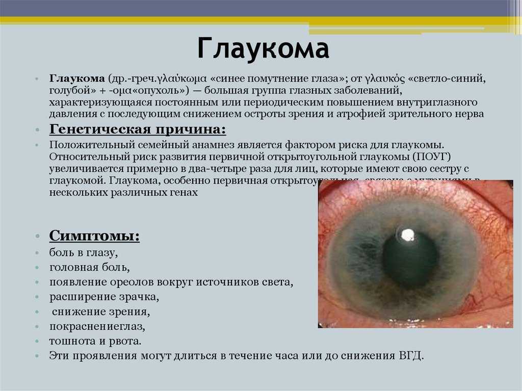 Глаукома у собак. причины, симптомы, диагностика и лечение.