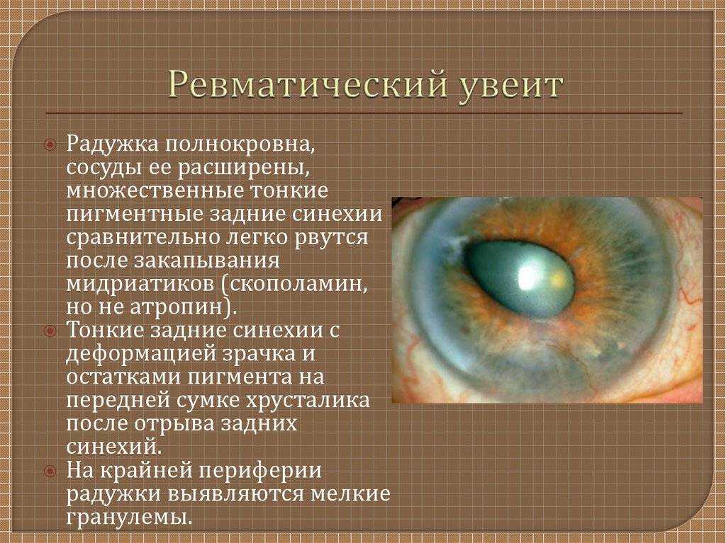 Воспаление роговицы (кератит) – как лечить у собак