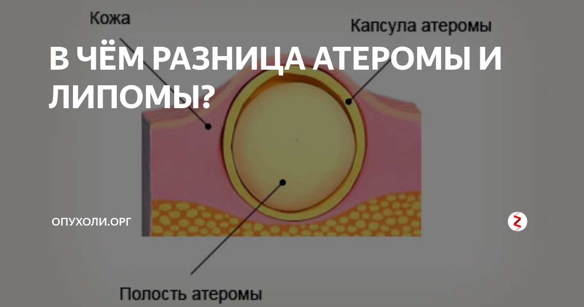 Жировик у собаки: как выглядит липома, симптомы ее появления и методы лечения