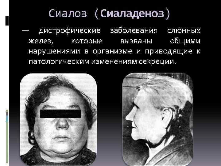 Воспаление десен у кошек