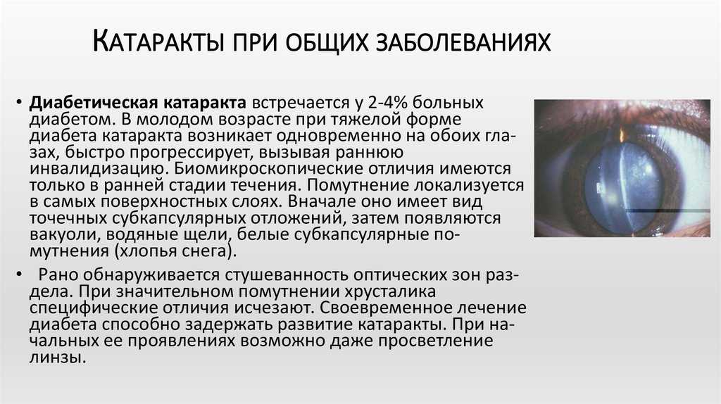 Катаракта у собак: симптомы, фото, лечение