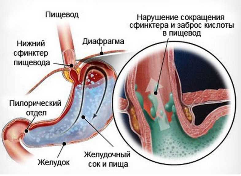 Изжога у собак