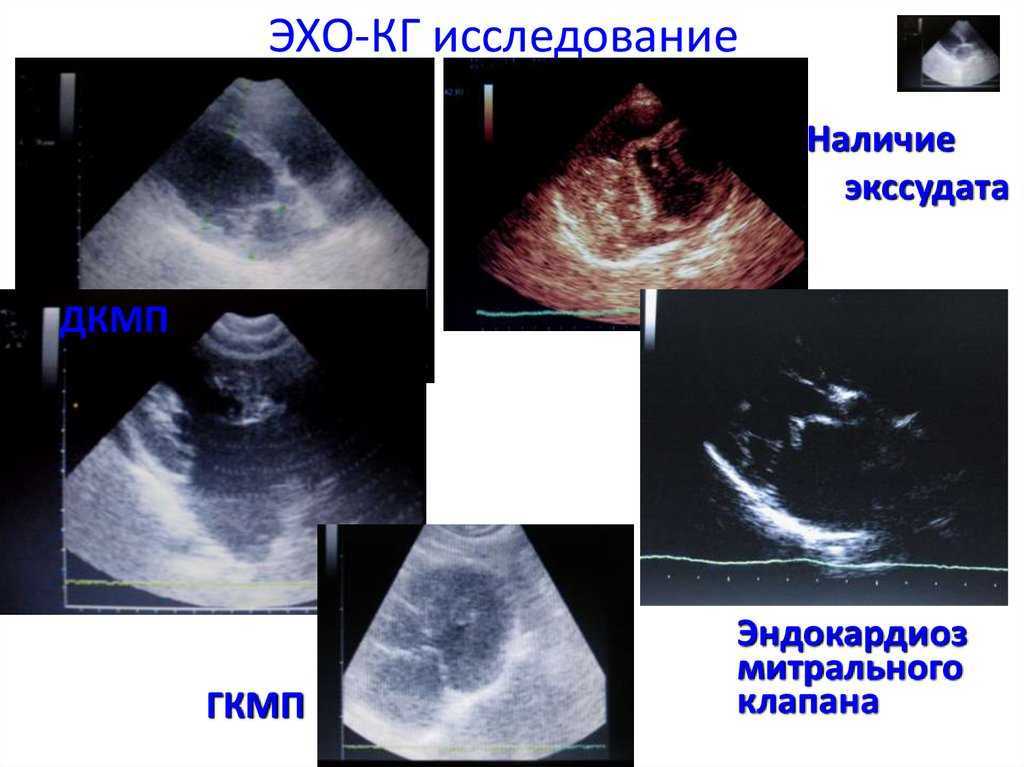 Эндокардиоз митрального клапана у собак: лечение и прогноз выживаемости, симптомы при 1, 2, 3 и 4 степени