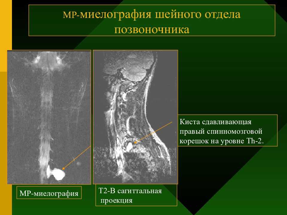 Техника миелографии у собаки - [2023]