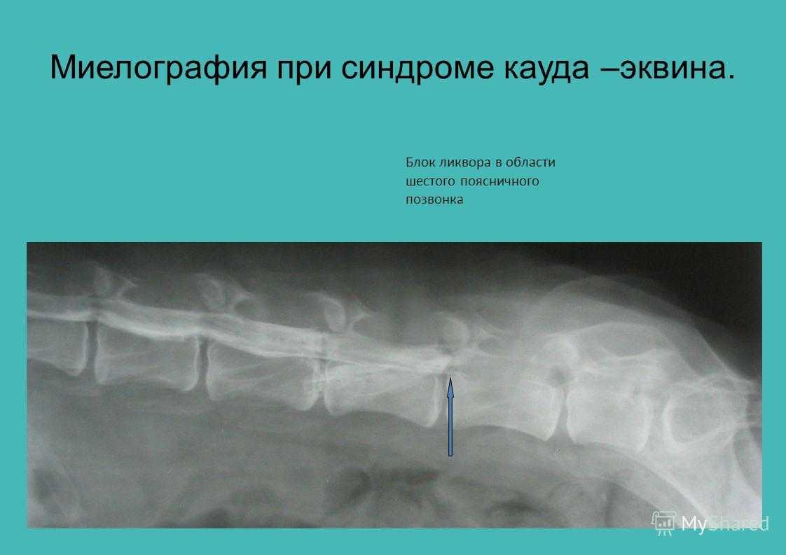 Контрастна спондилографія (мієлографія) у собак