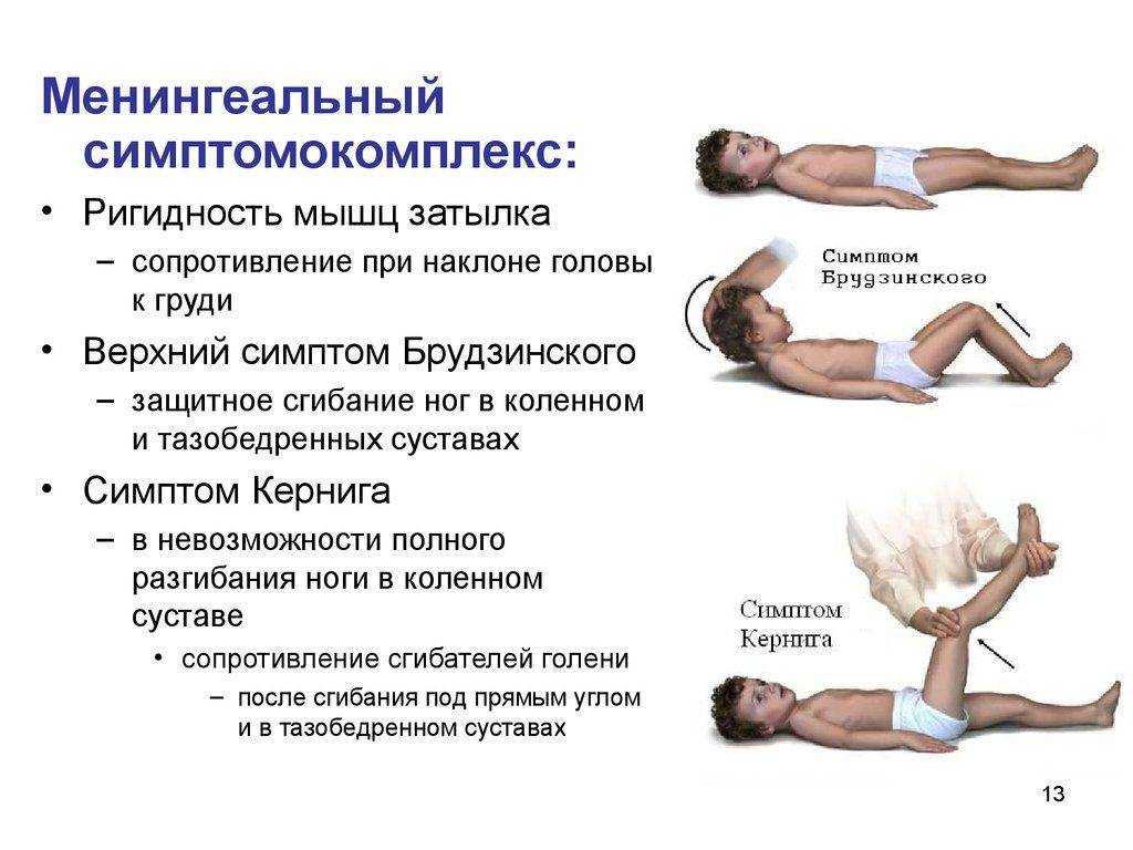 Менингоэнцефалит у собак: симптомы, прогноз и лечение некротизирующего и гранулематозного видов