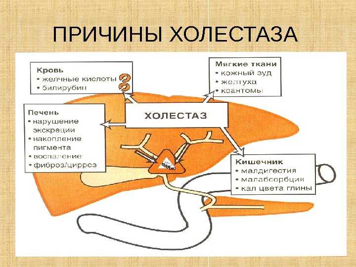 Холецистит у кошек. причины появления холецистита. симптомы болезни печени. методы лечения холецистита у кошек.