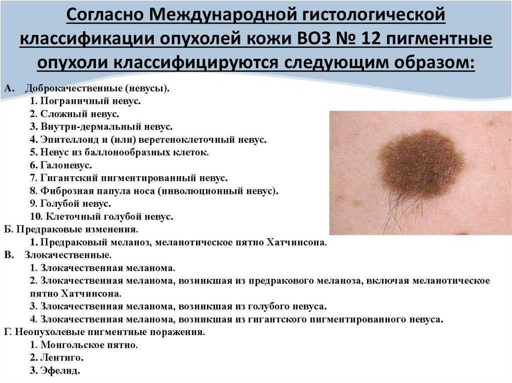 Новообразования у собак на коже, веках, лапах, ушах: фото, названия болезней, причины, симптомы и лечение доброкачественных и злокачественных опухолей