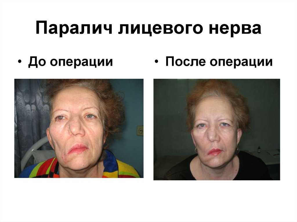 Паралич гортани у собак