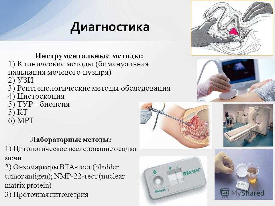 Как собрать мочу у кошки для анализа, как заставить кота пописать?