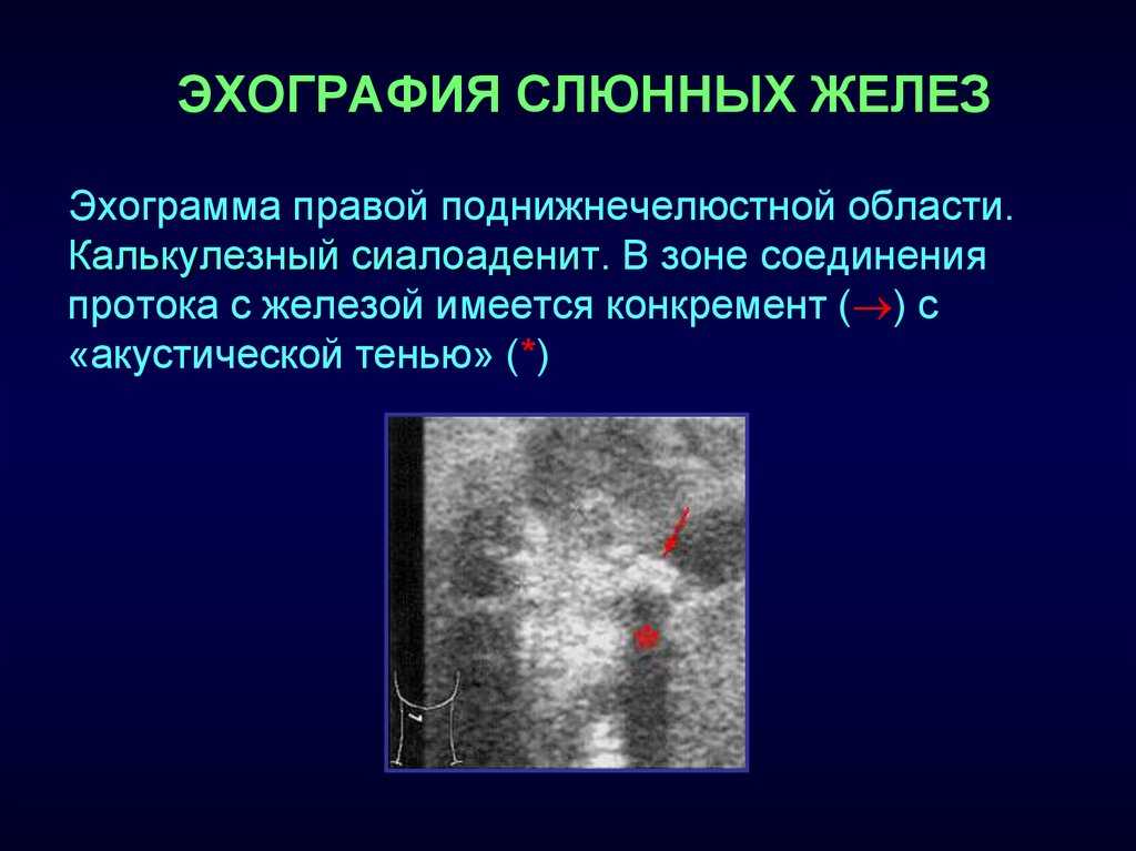 Воспаление слюнной железы у кошек: виды и формы воспалений, первые признаки, методы лечения и профилактики