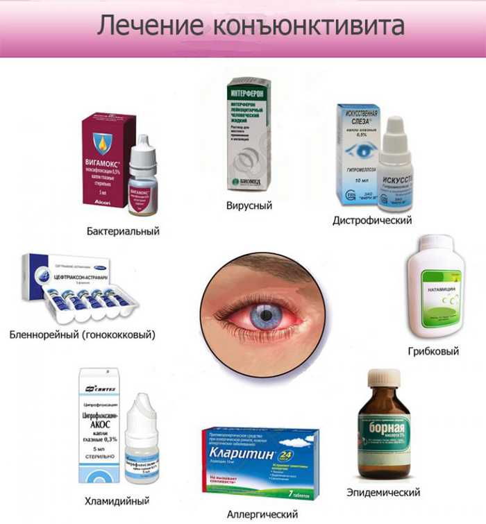 У собаки гноятся глаза: почему, что делать и как лечить, причины, если глаз красный или слезится, чем обработать опухший с шишкой, а также чем и как промыть?