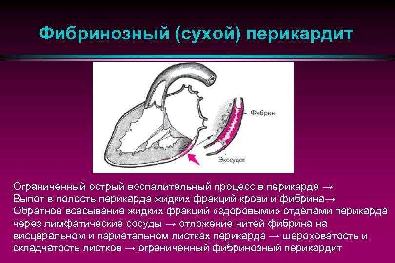 Перикардит у кошек: основные патологии вызывающие воспаление