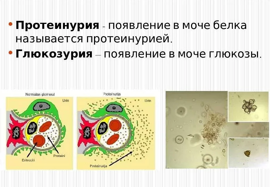 Белок в моче у кота - симптомы, диагностика, лечение