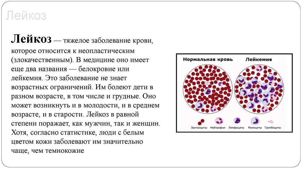 Первые симптомы лейкоза у кошек