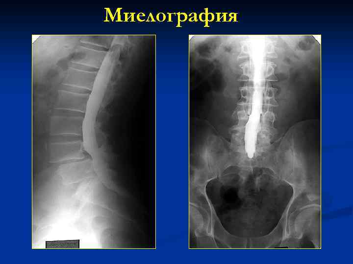 Дископатия у собак: симптомы и лечение
