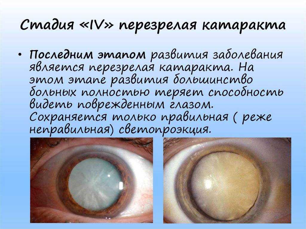 Катаракта у собак