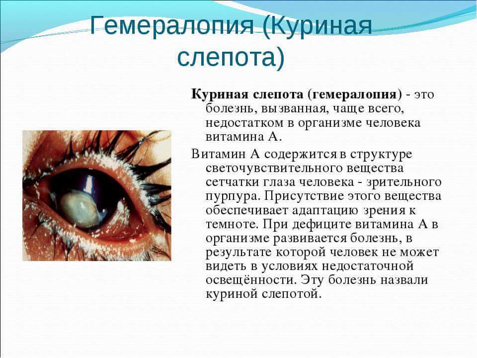 9 основных причин, почему собака может ослепнуть, какие породы в группе риска