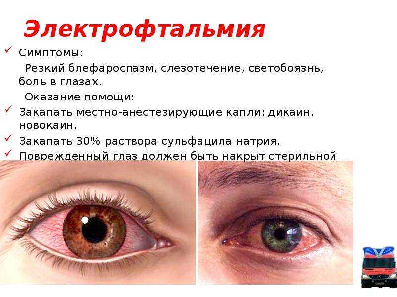 Болезни век у собак – блефарит, заворот, наросты