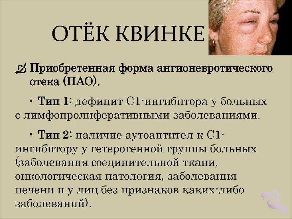 Симптомы отека квинке у кошек