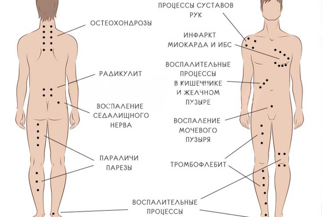 Где у кота мочевой пузырь?