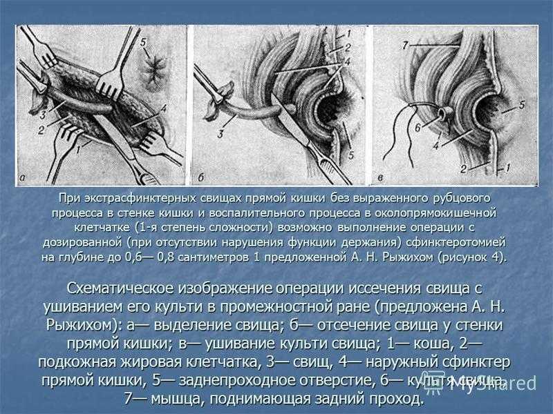 Что за болезнь свищ у собаки