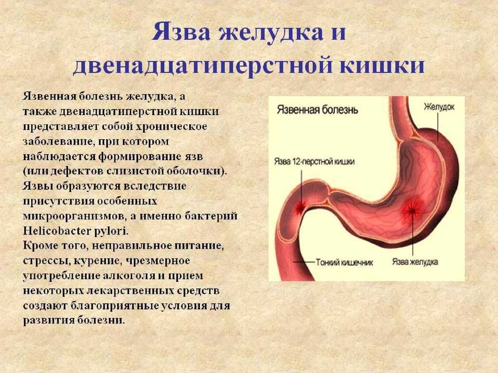 Что такое хеликобактер пилори (helicobacter pylori)? пути заражения хеликобактером