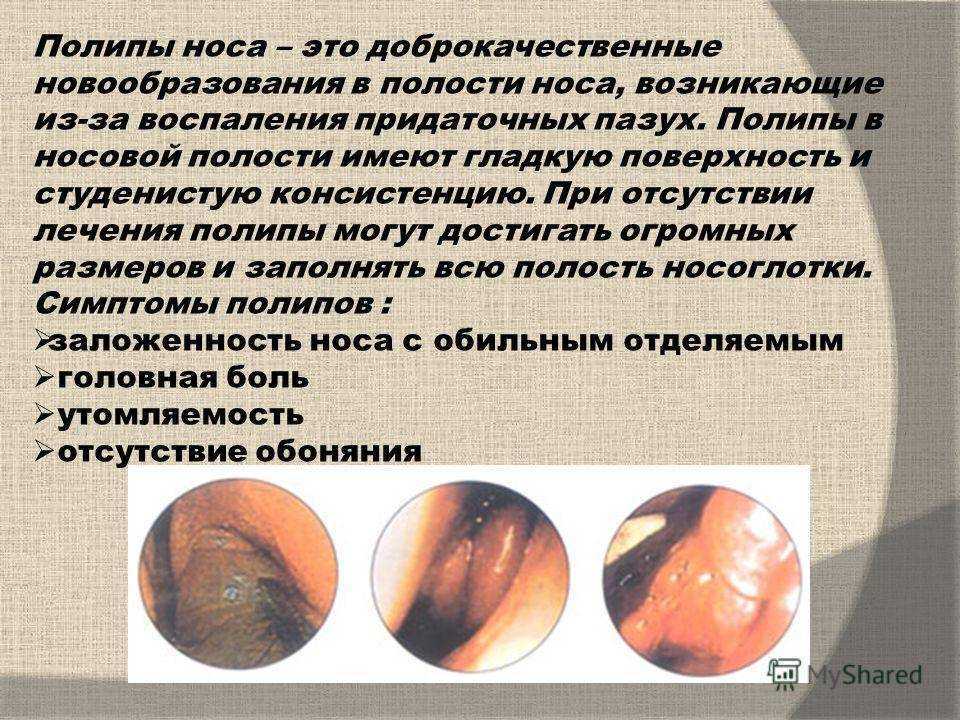 Полипы у кошек - симптомы и лечение полипов в мочевом пузыре, в носу, в ухе