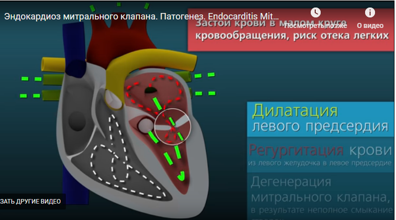 Сердечная недостаточность у собак. 5 причин плохой работы сердца: симптомы и лечение