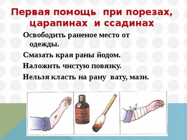 Как определить ушиб лапы у кота? переломы, растяжения, вывихи и ушибы у кошек кошка подвернула лапу заднюю чем лечить.